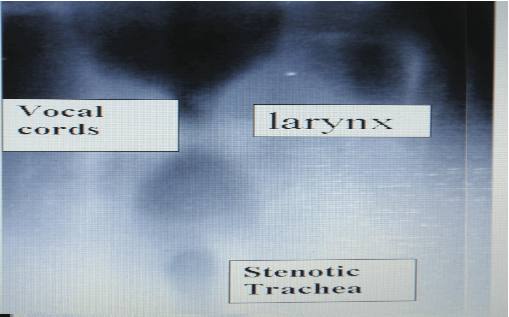 fig 1 image