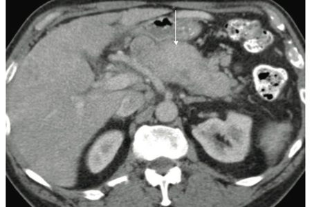fig1 image