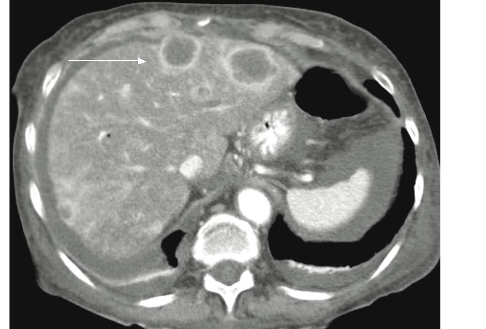 fig4 image