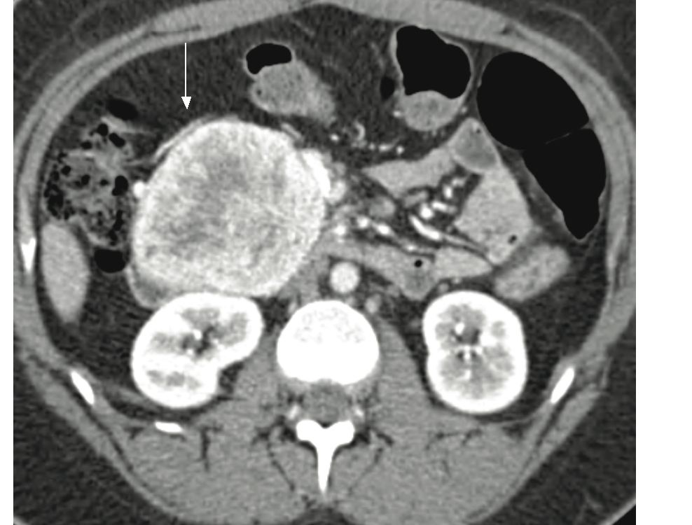 fig2 image