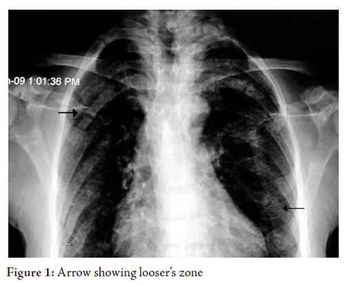 Asskeletal x-ray and